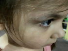  «Не в бровь, а в глаз»: качели на детской площадке в Приморском парке стали причиной травмы
