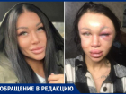 Популярного косметолога Таганрога избил до неузнаваемости её молодой человек