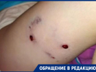 "Травмированная психика и шрам на всю жизнь": в Таганроге на ребёнка напала бродячая собака