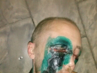 В центре Таганрога мужчину изувечили, плеснув в лицо кислотой