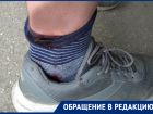 В Таганроге во время прогулки с ребёнком на таганрожца напала бродячая собака 