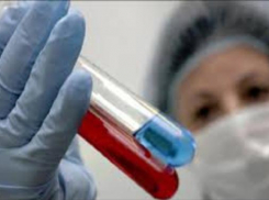 Возвращение вируса гриппа 2009 года ожидается осенью в России