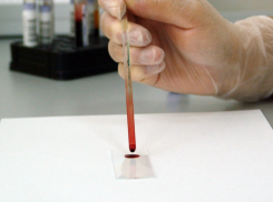 «Плохой» холестерин и холестериновые бляшки: популярный миф развенчали таганрогские врачи