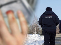 Откусил палец и ушел безнаказанным: где справедливость в Таганроге?