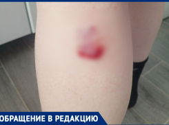 Проблема никуда не делась: бездомная собака напала на ребенка в Таганроге