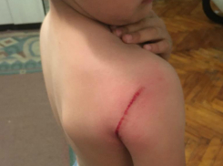 Семилетний Никита открыл счет травмированных детей на убитых и убогих площадках Таганрога