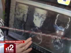 «Рудик ни в чём не виноват» - уже 2 года полиция Таганрога не задерживает подозреваемого в жестоком избиении