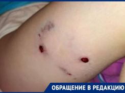 «Травмированная психика и шрам на всю жизнь»: в Таганроге на ребёнка напала бродячая собака