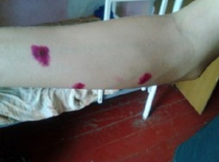 В детском лагере под Таганрогом дети подхватили лишай