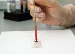 "Плохой" холестерин и холестериновые бляшки: популярный миф развенчали таганрогские врачи