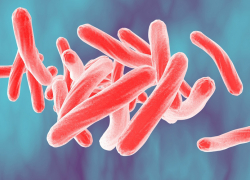 О необходимости профилактики туберкулёза в Таганроге и области