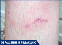  Еще одна жертва бездомных животных в Таганроге – собаки искусали 13-летнего подростка