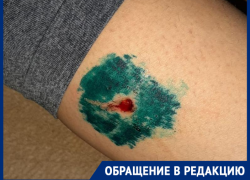 Агрессивные бродячие собаки  покусали юную таганроженку