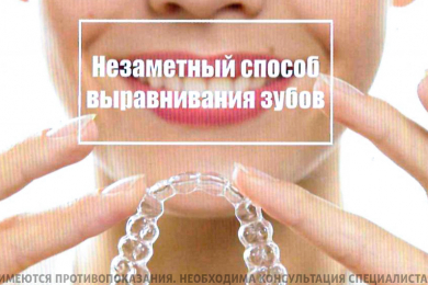 Выравнивание зубов с помощью элайнеров в клинике «Дантист» - 