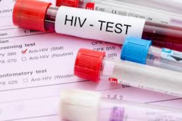 В Таганроге зарегистрирован 470 ВИЧ-инфицированных