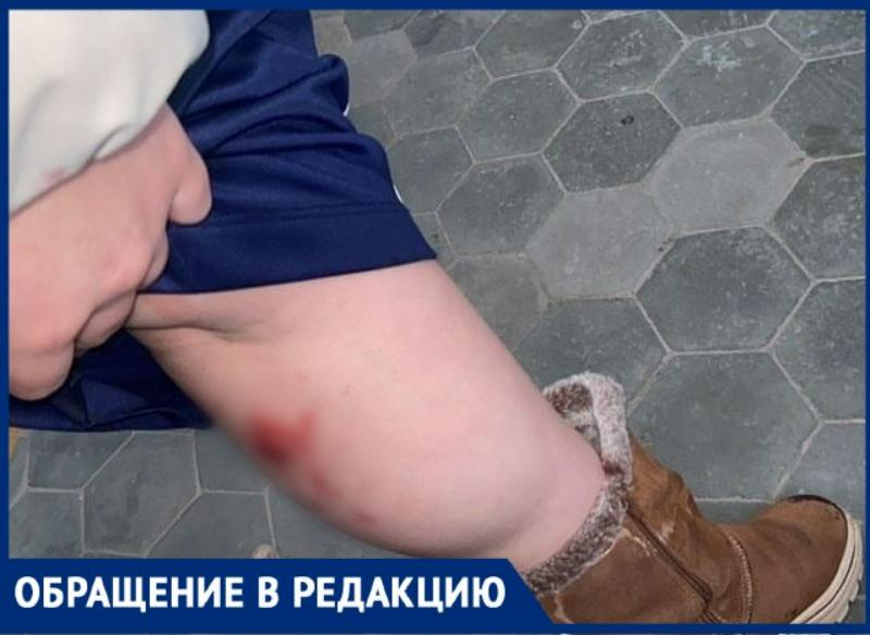 В Таганроге бездомная собака искусала 15-летнюю девочку