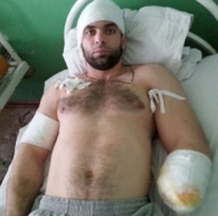 Таганрогскому чемпиону по паурлифтингу ампутировали руку после удара током в 6000 вольт